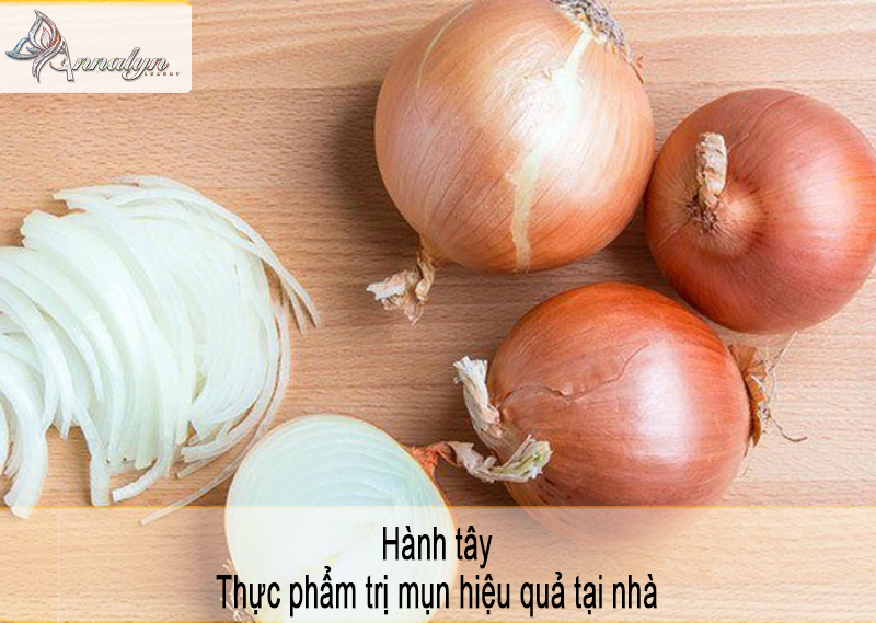 Hành-tây-trị-mụn